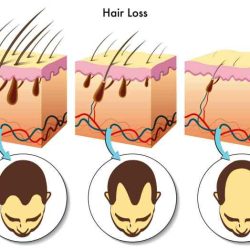 Hairs pore many come hair each donovan follicle compound grows normal mildlyinteresting clinic