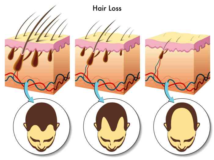 Hairs pore many come hair each donovan follicle compound grows normal mildlyinteresting clinic